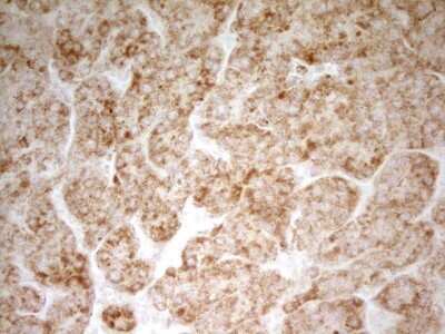 Immunohistochemistry: MRRF Antibody (OTI1D5) [NBP2-45434]
