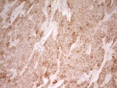 Immunohistochemistry: MRRF Antibody (OTI1D5) [NBP2-45434]