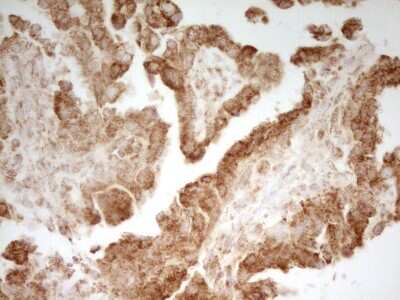 Immunohistochemistry: MRRF Antibody (OTI1D5) [NBP2-45434]
