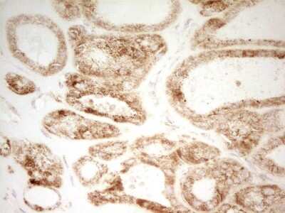 Immunohistochemistry: MRRF Antibody (OTI1D5) [NBP2-45434]
