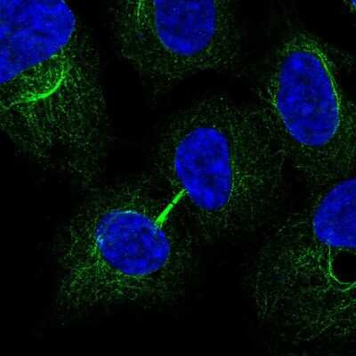 Immunocytochemistry/ Immunofluorescence: MRRF Antibody [NBP2-33586]