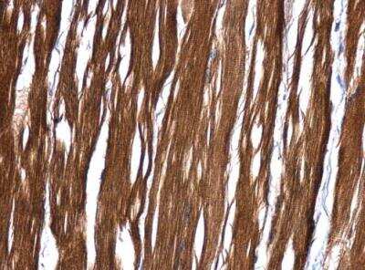 Immunohistochemistry-Paraffin: MRRF Antibody [NBP2-15025]