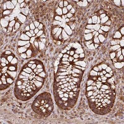 Immunohistochemistry-Paraffin: MRRF Antibody [NBP2-33481]