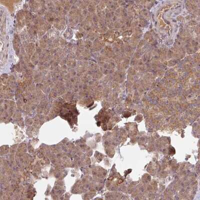 Immunohistochemistry-Paraffin: MRRF Antibody [NBP2-33481]