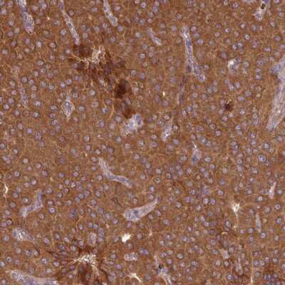 Immunohistochemistry-Paraffin: MRRF Antibody [NBP2-33481]