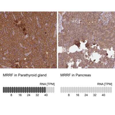 Immunohistochemistry-Paraffin: MRRF Antibody [NBP2-33481]