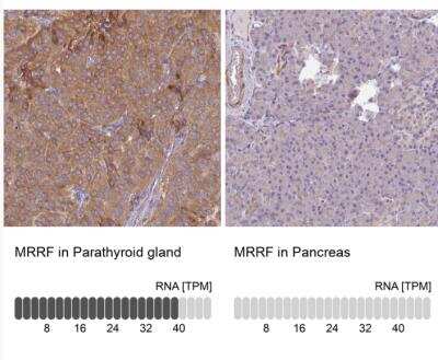 Immunohistochemistry-Paraffin: MRRF Antibody [NBP2-33586]