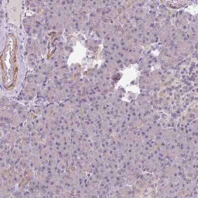 Immunohistochemistry-Paraffin: MRRF Antibody [NBP2-33586]