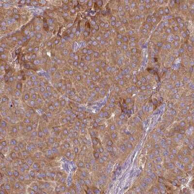 Immunohistochemistry-Paraffin: MRRF Antibody [NBP2-33586]