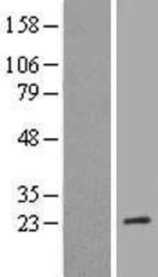 Western Blot: MRRF Overexpression Lysate [NBL1-13309]