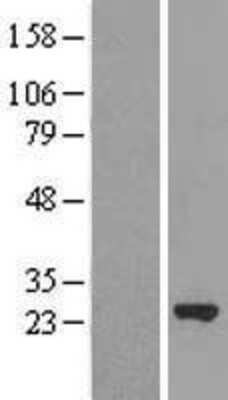 Western Blot: MRRF Overexpression Lysate [NBL1-13310]