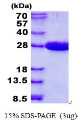 SDS-PAGE: Recombinant Human MRRF His Protein [NBP2-23244]