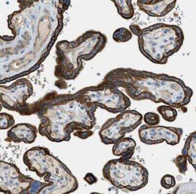 Immunohistochemistry-Paraffin: MRS2 Antibody [NBP2-34200]