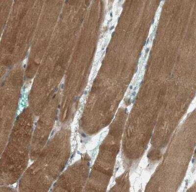 Immunohistochemistry-Paraffin: MRS2 Antibody [NBP2-34200]