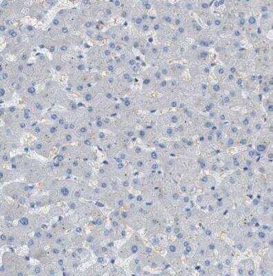 Immunohistochemistry-Paraffin: MRS2 Antibody [NBP2-34200]