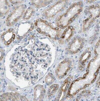 Immunohistochemistry-Paraffin: MRS2 Antibody [NBP2-34200]