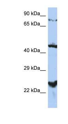 Western Blot: MRS2 Antibody [NBP1-59614]