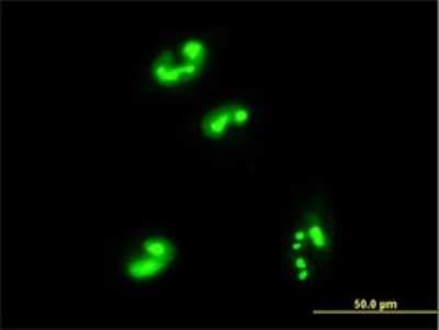Immunocytochemistry/ Immunofluorescence: MRTO4 Antibody (1C12) [H00051154-M01]