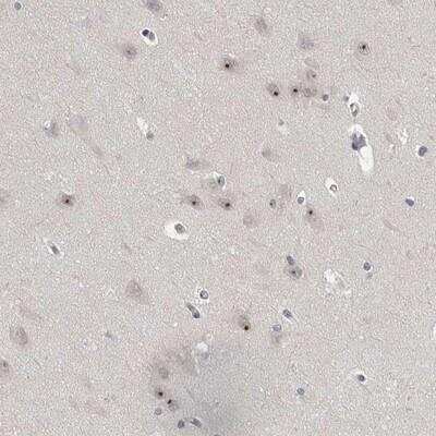 Immunohistochemistry-Paraffin: MRTO4 Antibody [NBP1-88334]