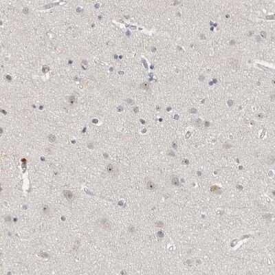 Immunohistochemistry-Paraffin: MRTO4 Antibody [NBP1-88334]