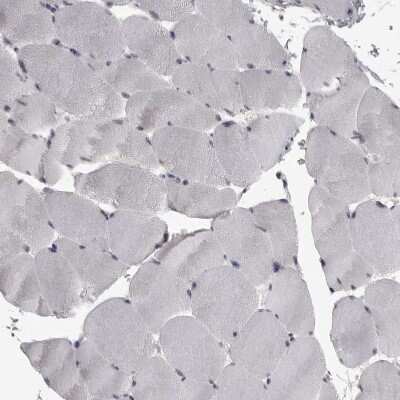 Immunohistochemistry-Paraffin: MRTO4 Antibody [NBP1-88334]
