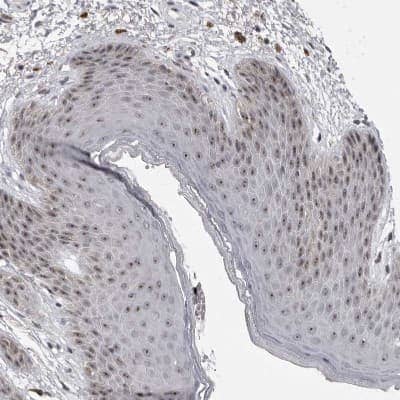 Immunohistochemistry-Paraffin: MRTO4 Antibody [NBP1-88334]