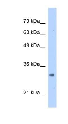 Western Blot: MRTO4 Antibody [NBP1-53203]