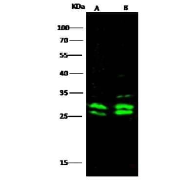 Western Blot: MRTO4 Antibody [NBP3-00348]