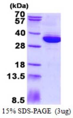 SDS-PAGE: Recombinant Human MRTO4 His Protein [NBP2-23251]