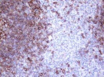 Immunohistochemistry-Paraffin: CD20 Antibody (OTI4B4) [NBP2-45454]