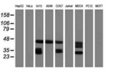 Western Blot: CD20 Antibody (OTI4B4) [NBP2-45454]
