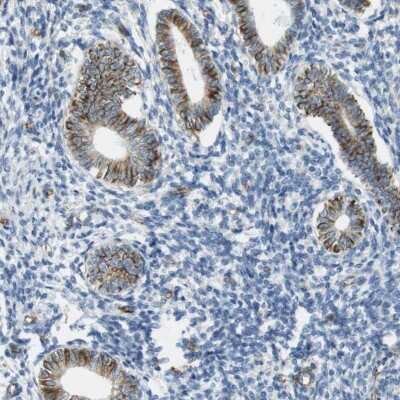 Immunohistochemistry-Paraffin: MS4A10 Antibody [NBP2-31998]