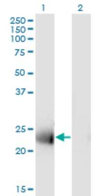 Western Blot: MS4A12 Antibody (4F4) [H00054860-M01]