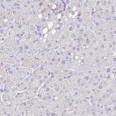 Immunohistochemistry-Paraffin: MS4A12 Antibody [NBP2-30744]