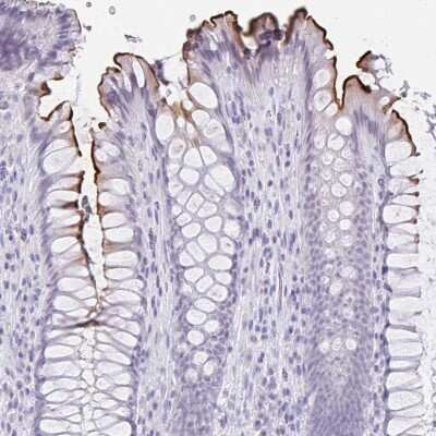 Immunohistochemistry-Paraffin: MS4A12 Antibody [NBP2-30744]