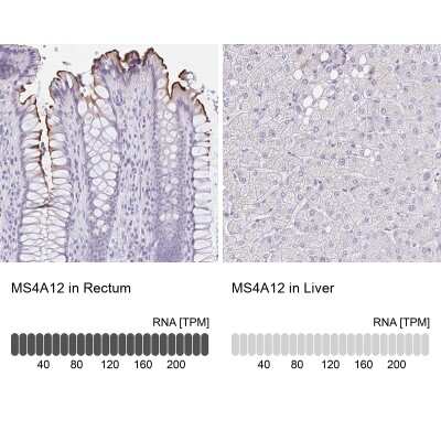 Immunohistochemistry-Paraffin: MS4A12 Antibody [NBP2-30744]