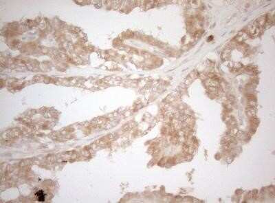 Immunohistochemistry: MS4A12 Antibody (OTI5F5) - Azide and BSA Free [NBP2-72791]