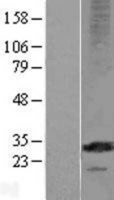 Western Blot: MS4A12 Overexpression Lysate [NBL1-13313]