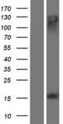 Western Blot: MS4A13 Overexpression Lysate [NBP2-08692]