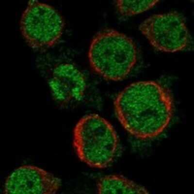 Immunocytochemistry/ Immunofluorescence: MS4A14 Antibody [NBP3-17604]