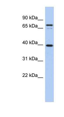 Western Blot: MS4A14 Antibody [NBP1-59621]