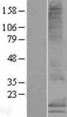 Western Blot: MS4A15 Overexpression Lysate [NBL1-13314]