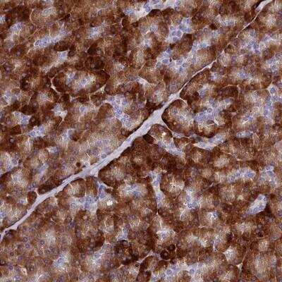 Immunohistochemistry-Paraffin: MS4A18 Antibody [NBP1-94170]