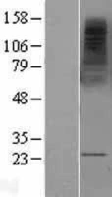 Western Blot: Fc epsilon RI beta/MS4A2 Overexpression Lysate [NBL1-13315]