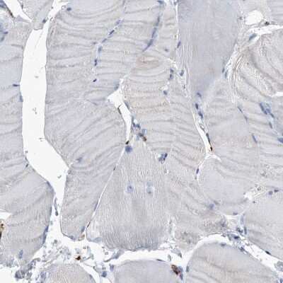 Immunohistochemistry-Paraffin: MS4A4A Antibody [NBP1-86542]