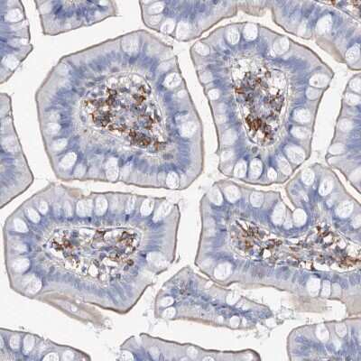 Immunohistochemistry-Paraffin: MS4A4A Antibody [NBP1-86542]