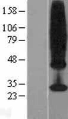 Western Blot: MS4A4A Overexpression Lysate [NBL1-13318]