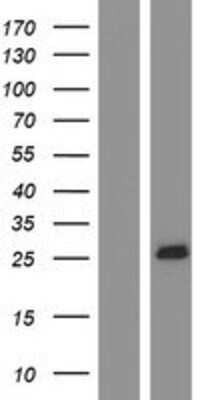 Western Blot: MS4A4A Overexpression Lysate [NBP2-04393]