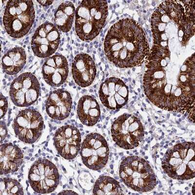 Immunohistochemistry-Paraffin: MS4A5 Antibody [NBP1-92143]