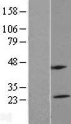 Western Blot: MS4A5 Overexpression Lysate [NBL1-13319]